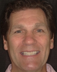 After Image