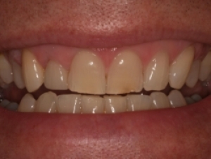 Before Image