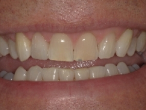 After Image
