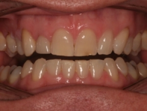 Before Image