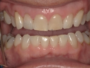 After Image