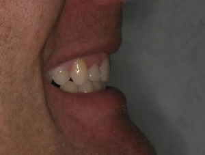 Before Image