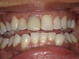 Before Image