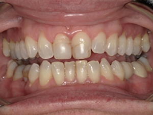 Before Image