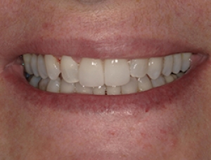After Image